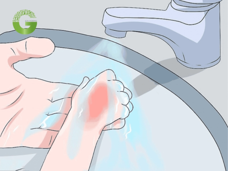 Cách xử lý đúng khi tiếp xúc với vôi tôi
