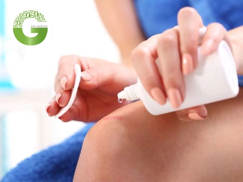 Những trường hợp không nên dùng oxy già sát khuẩn