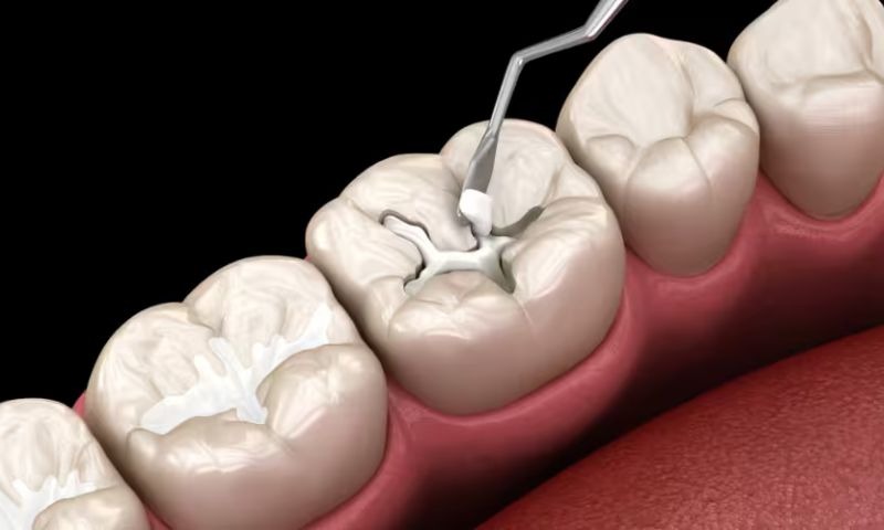 Ca(OH)2 được ứng dụng trong cả lĩnh vực y khoa