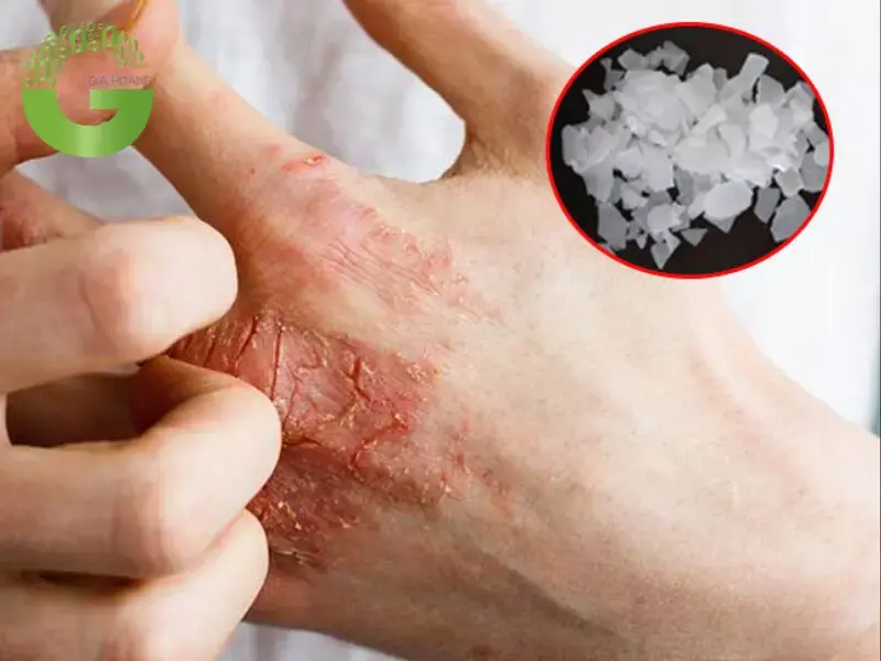 cách sử dụng xút cách sử dụng xút