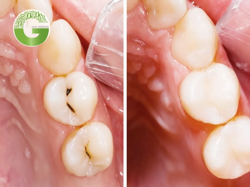 Công dụng trong y tế và nha khoa