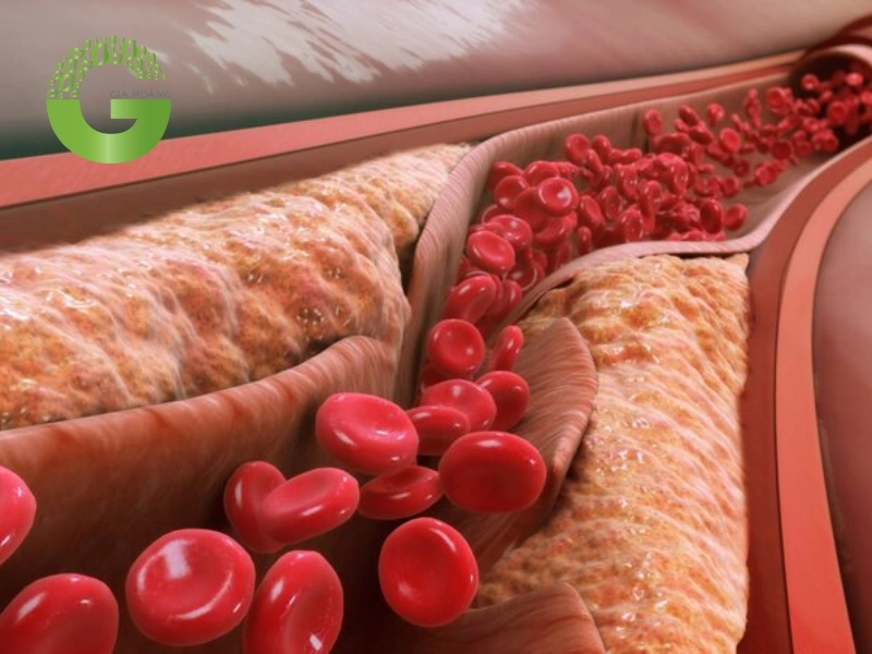 than hoạt tính giảm cholesterol